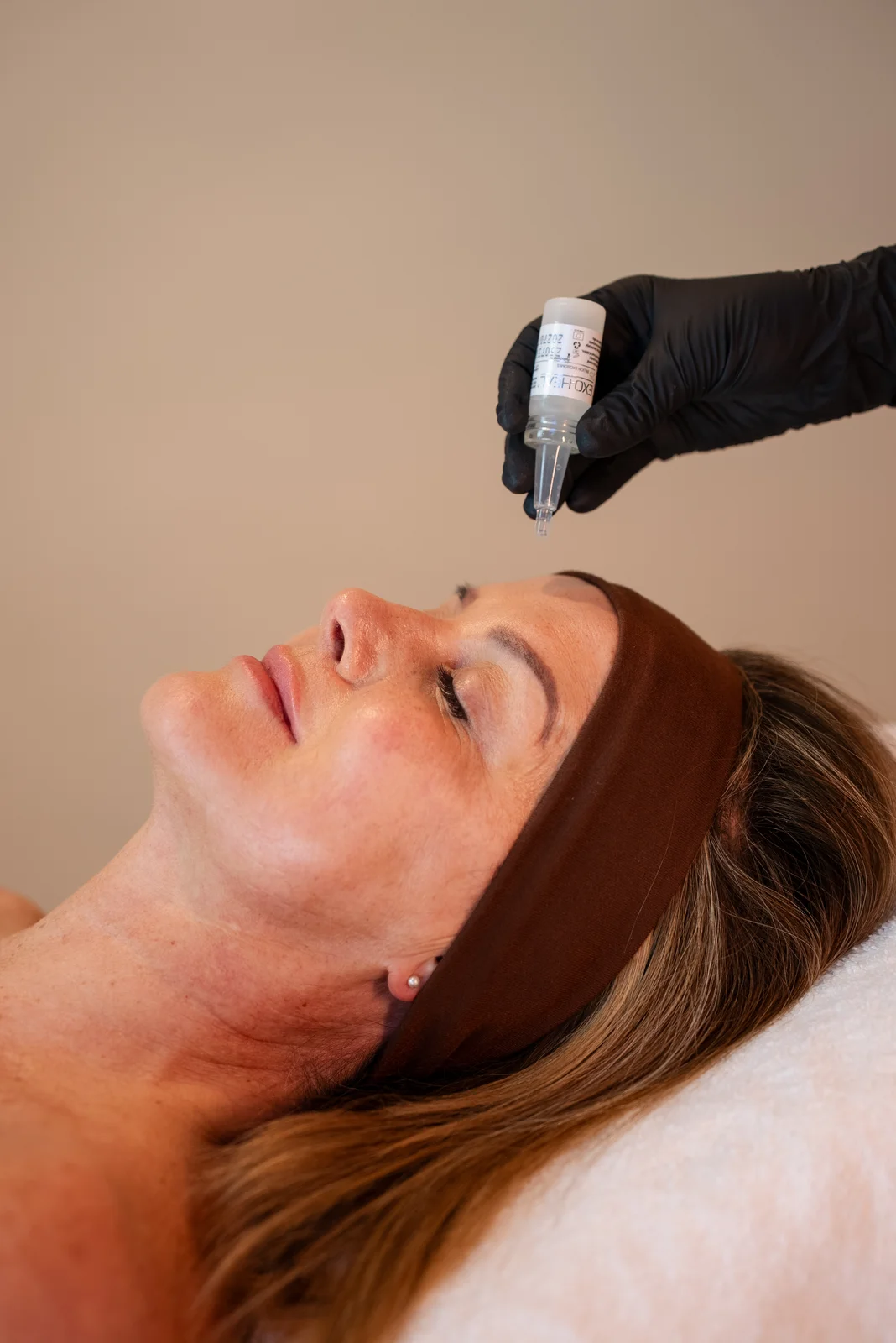 Chemische Peeling