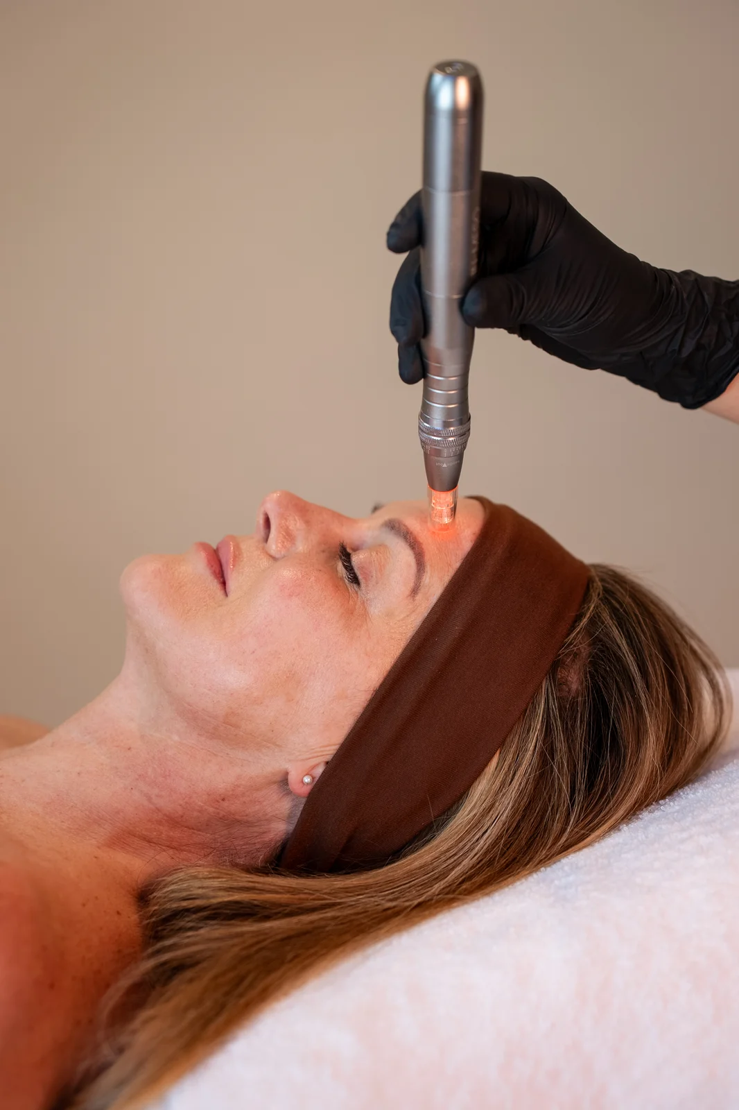 Microneedling