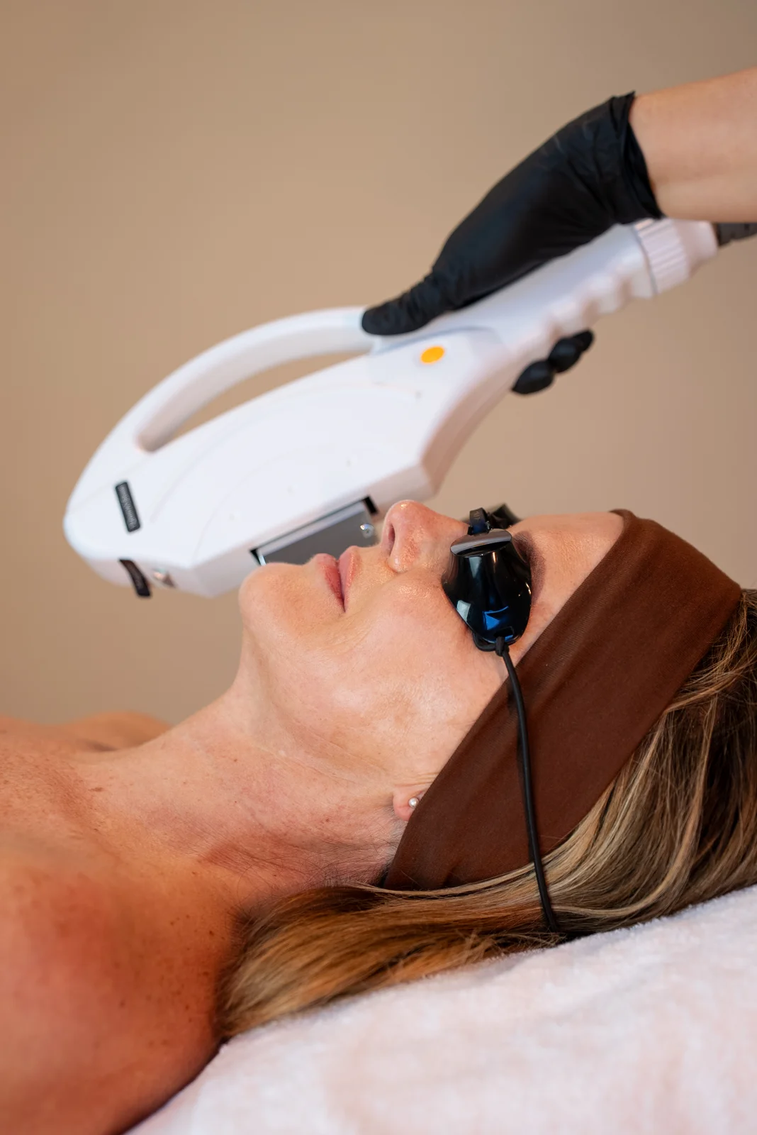 SKIN Centrum IPL behandeling