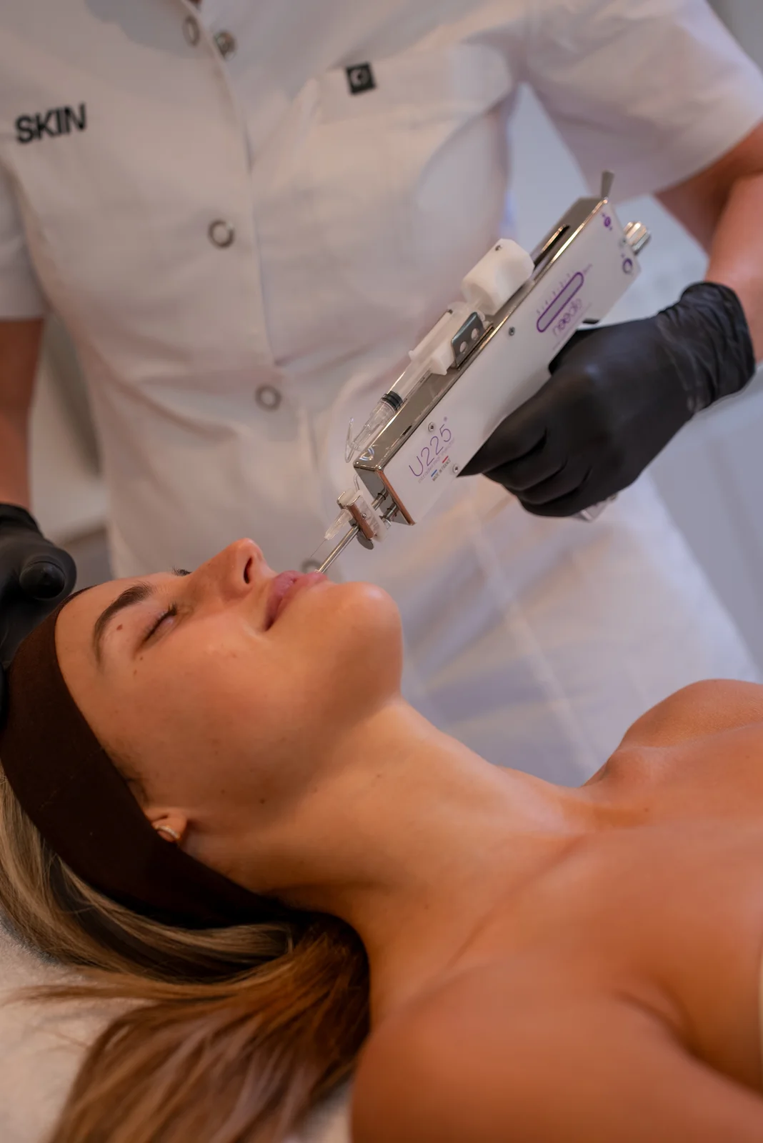 Microneedling met Polynucleotiden (Zalm-DNA)