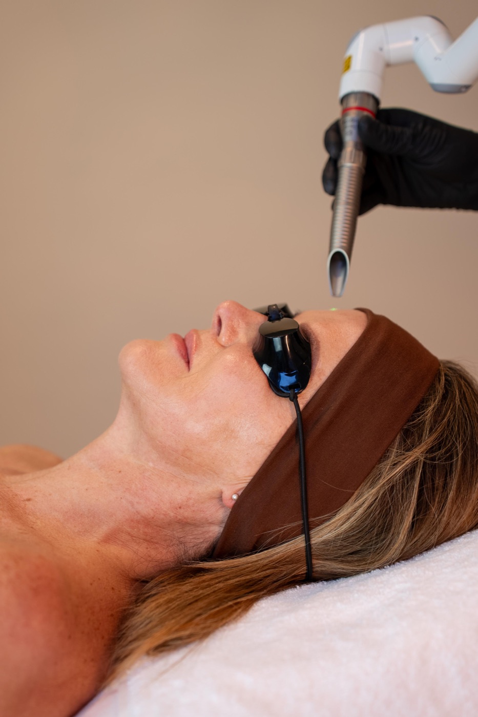 Fotona 4D laser treatment at SKIN Amsterdam — skin tightening and firming